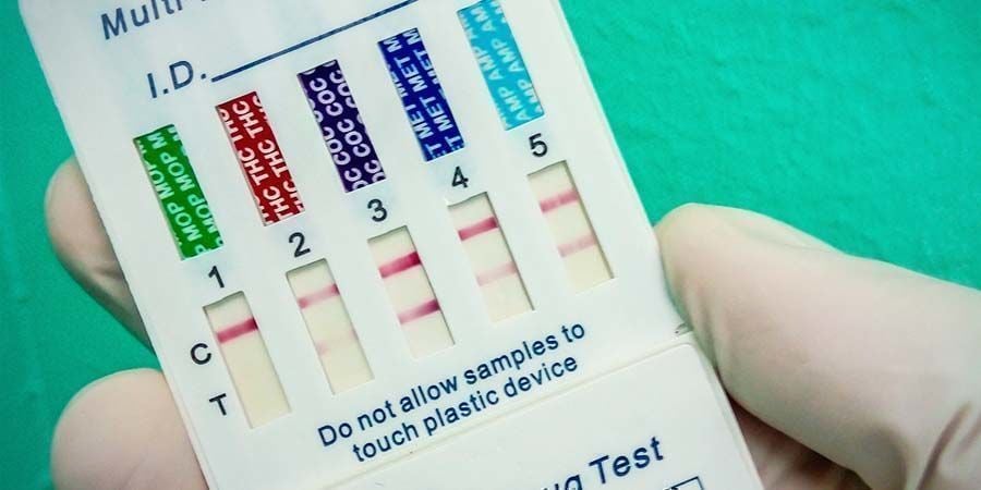 Che cosa determina un test antidroga positivo?