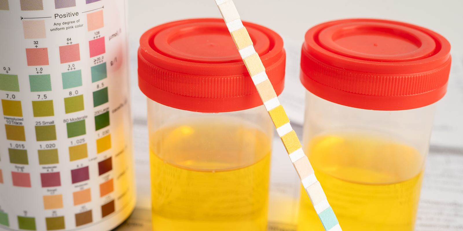 Finestra di rilevamento