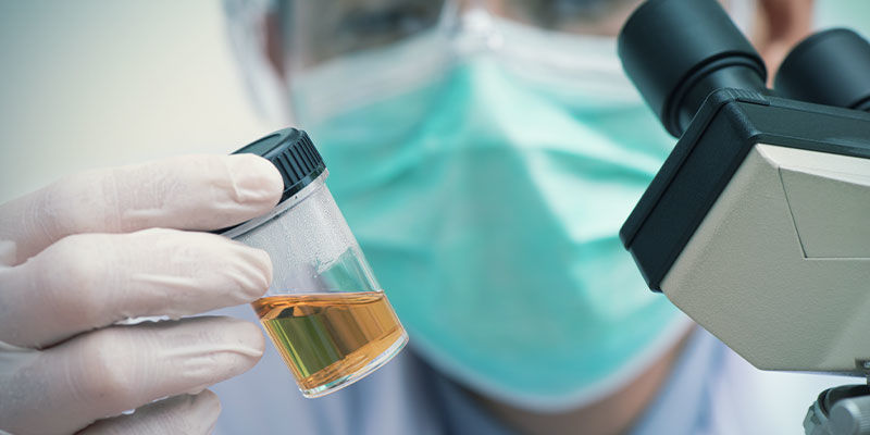 Esempi Di Ciò Che Viene Analizzato In Un Campione Di Urine