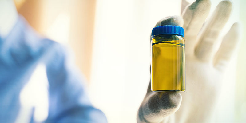Cosa Succede Se Il Test Antidroga Non Viene Superato?