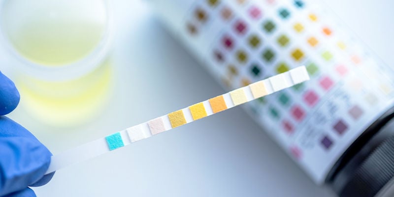 Come funzionano i test antidroga per il THC?