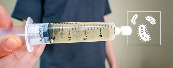 Cos'è la coltura liquida dei funghi? Una guida completa per principianti
